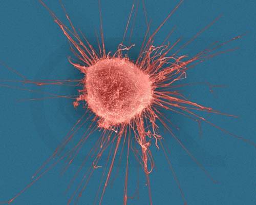 Odborníci z americké Stanford University teď možná nalezli vhodný způsob, jak zničit rakovinové buňky, aniž by poškodili ty zdravé.