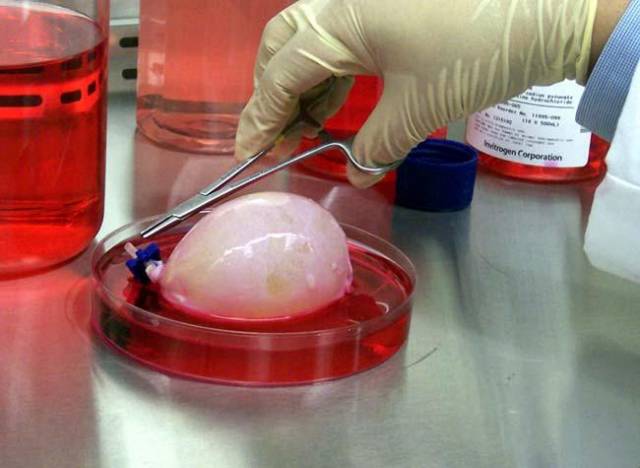 Vědcům se poprvé v historii podařilo z odebraných buněk vypěstovat kompletní lidský orgán.