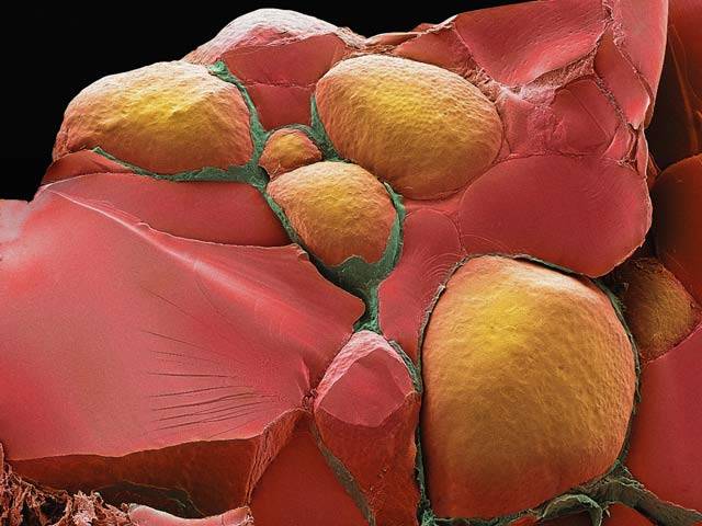 Makrosnímek štítné žlázy, pořízený elektronovým mikroskopem a dodatečně kolorovaný nám poskytuje unikátní pohled na jeden z důležitých orgánů, řídících hormonální funkce našeho organismu. Na snímku vidíme oranžové a zelené míšky, mezi nimiž je červená pojivová tkáň.