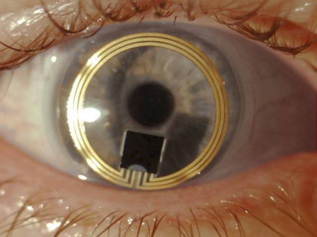 Glaukom, lidově zvaný zelený zákal, je jedno z nejběžnějších onemocnění zraku a také druhá nejčastější příčina slepoty. Problémy s ním spočívají hlavně v tom, že z počátku je prakticky bez příznaků. Jeho včasnému určení by mohly napomoci speciální kontaktní čočky vyvinuté specialisty švýcarské firmy Sensimed. 