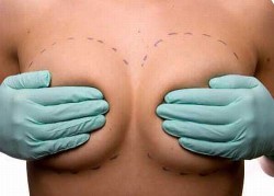 Image thumbnail