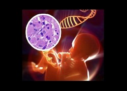 Image thumbnail