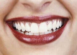 Image thumbnail