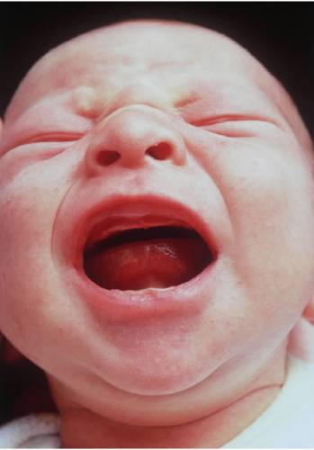 Sperma zmrazené 21 let zplodilo chlapceVe Velké Británii se narodil chlapec, při jehož početí bylo použito spermatu zmrazeného před jednadvaceti lety, čímž pravděpodobně vznikl nový světový rekord. Otec dítěte si nechal zmrazit sperma, když mu bylo 17 a zahájil úspěšnou léčbu rakoviny. Mužovo sperma bylo uloženo ve zkapalněném dusíku dvě desetiletí a bylo rozmrazeno ve chvíli, kdy se rozhodl oženit a založit rodinu. Dítě se narodilo dva roky poté, co se nepovedly čtyři pokusy o oplodnění ve zkumavce. 