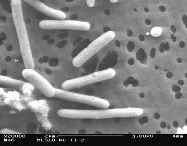 Některé mikroby mají mnohostranné využití.Anaerobní bakterie, které místo kyslíku »dýchají« selen, vylučují na svém povrchu stejnorodé kulové nanočástice tohoto prvku o průměru 300 nm.