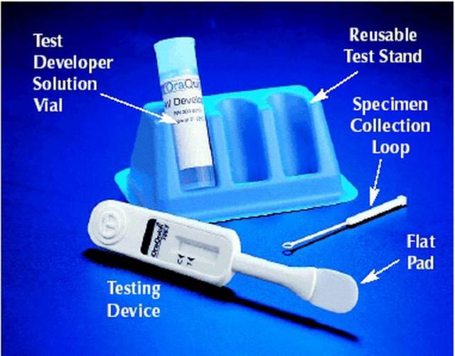 Nový test na detekci přítomnosti HIV viru vyvinula a vyrábí pod značkou Ora-Quick ADVANCE Rapid HIV Antibody Test americká společnost OraSure Technologies.