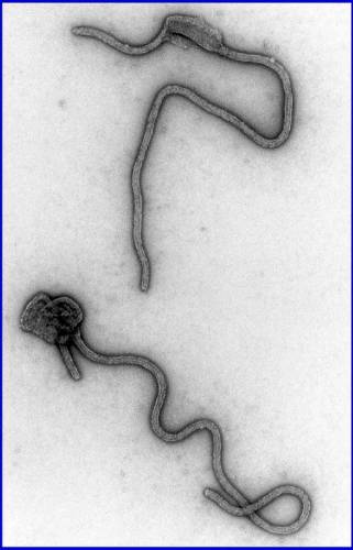 Vakcína proti smrtelnému viru Ebola, vyvinutá v National Institute of Health, se začíná testovat na lidech.
