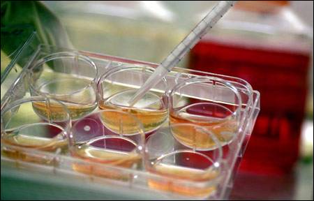 Vědecký tým z Advanced Cell Technology v Bostonu nedávno úspěšně testoval nový, bezpečnější způsob pro kultivaci embryonálních kmenových buněk.