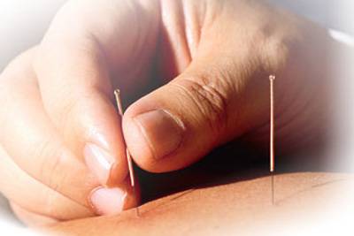 Britští vědci poprvé prokázali léčivé účinky akupunktury. Při rozsáhlé studii se zaměřili především na zkoumání mozkových reakcí na léčbu.