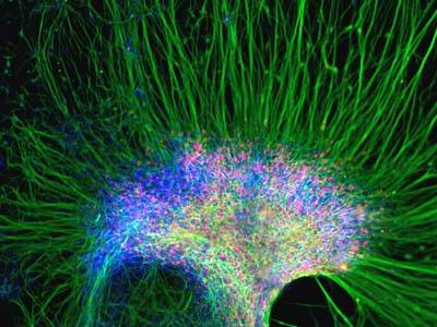 Odborníci ze skotského Edinburgu jako první na světě nyní vytvořili neporušené nervové kmenové buňky z lidských kmenových buněk.