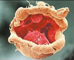 Voliči amerického státu Kansas překvapivě podporují výzkum kmenových buněk získaných z naklonovaných lidských embryí.