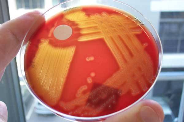 Dá se vyrobit umělá bakterie?