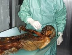 5000 let stará alpská mumie se podrobila podrobnému lékařskému vyšetření.