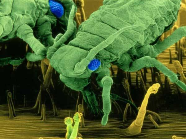 Díky nejnovějším metodám mají nyní vědci lepší přehled o tom, jaké bakterie obývají povrch naší kůže. Mezi dvěma stovkami druhů našli dokonce zcela neznámé mikroby.