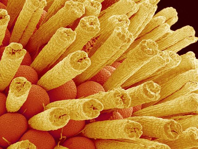 Jak vypadá jahoda pod elektronovým mikroskopem?