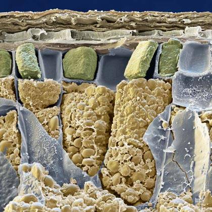 Žluté kukuřičky na obrázku ve skutečnosti nejsou kukuřičné palice, ale úplně jiné obilí. Jedná se o buňky k prasknutí nacpané škrobovými zrny (žlutě) v pšeničném zrnu, zvětšené 2400 x. Šedivá potrhaná fólie představuje buněčné stěny.