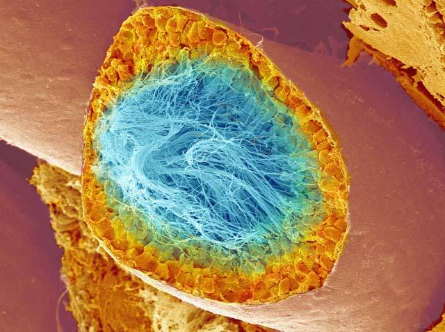 Na snímku z elektronového skenovacího mikroskopu je příčný řez zmrazeného semenotvorného kanálku v mužském varleti, ve kterém vznikají nové spermie.