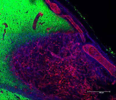 Američtí vědci nedávno připravili speciální gel, který bude napomáhat k regeneraci drobných cévek po mozkových příhodách. Zvyší se tak naděje, že pacient bude žít stejně kvalitní život jako před nehodou.