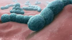 Meningokokové infekce: fakta a mýty o nemoci, která ničí lidské životy