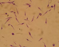 Vědci z Olomouce hledají účinné látky proti parazitickým prvokům z rodu Leishmania