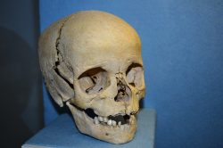 V kutnohorské kostnici vědci narazili na oběti hladomoru i morových epidemií