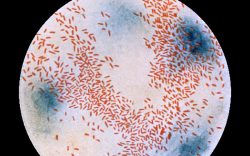 Zákeřná bakterie způsobuje vážná onemocnění malých dětí