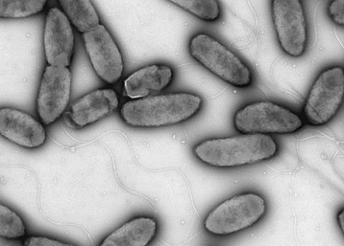 Češi objevili novou bakterii