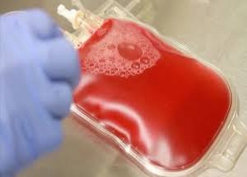 Krev z pupečníku základem umělé kosti