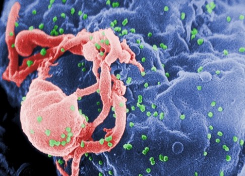 Virus HIV ztrácí na síle