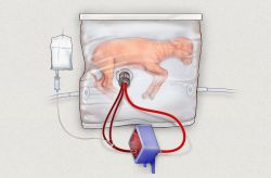 Předčasně narozeným dětem bude život zachraňovat umělá děloha