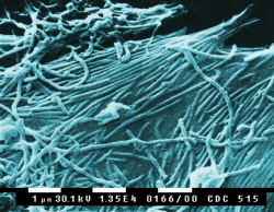 Virus Ebola přežívá v semenu až 9 měsíců