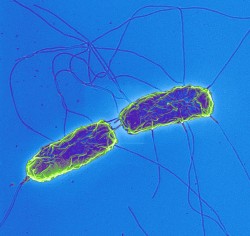 Země třetího světa decimuje zmutovaná bakterie břišního tyfu